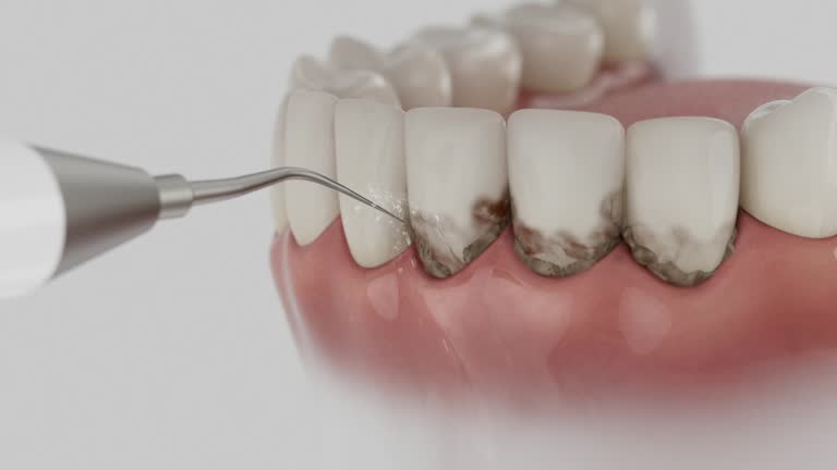 Reliable Emergency Dentist contractor in Brielle, NJ by Smile Center Dentistry